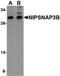 Nipsnap Homolog 3B antibody, PA5-20658, Invitrogen Antibodies, Western Blot image 