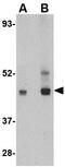 Platelet Activating Factor Acetylhydrolase 1b Regulatory Subunit 1 antibody, GTX16993, GeneTex, Western Blot image 