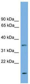 Limb And CNS Expressed 1 Like antibody, TA337816, Origene, Western Blot image 