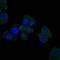 Homeostatic Iron Regulator antibody, NBP2-37555, Novus Biologicals, Immunocytochemistry image 