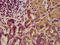 Leucine Rich Repeat LGI Family Member 4 antibody, LS-C674448, Lifespan Biosciences, Immunohistochemistry paraffin image 