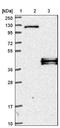 Retinoic Acid Receptor Responder 1 antibody, NBP1-80684, Novus Biologicals, Western Blot image 