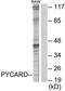 PYCARD antibody, TA326289, Origene, Western Blot image 