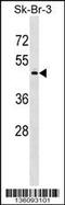 PAPD7 antibody, 58-801, ProSci, Western Blot image 