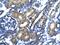 SP140 Nuclear Body Protein antibody, ARP32854_T100, Aviva Systems Biology, Immunohistochemistry paraffin image 