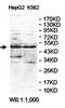 ANTXR Cell Adhesion Molecule 1 antibody, orb78316, Biorbyt, Western Blot image 