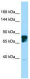 SLIT And NTRK Like Family Member 4 antibody, TA331600, Origene, Western Blot image 