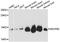 NADH:Ubiquinone Oxidoreductase Subunit B2 antibody, A3978, ABclonal Technology, Western Blot image 