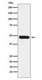 ERCC Excision Repair 8, CSA Ubiquitin Ligase Complex Subunit antibody, M04153-1, Boster Biological Technology, Western Blot image 
