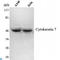 Keratin 7 antibody, LS-C812934, Lifespan Biosciences, Western Blot image 