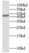 Dpc4 antibody, FNab07997, FineTest, Western Blot image 