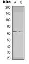 ETS Transcription Factor ELK1 antibody, orb338849, Biorbyt, Western Blot image 