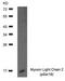 Myosin regulatory light chain 2, ventricular/cardiac muscle isoform antibody, TA309976, Origene, Western Blot image 