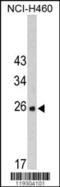 Peptidyl-prolyl cis-trans isomerase FKBP14 antibody, MBS9206127, MyBioSource, Western Blot image 