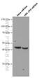 FA Complementation Group L antibody, 66639-1-Ig, Proteintech Group, Western Blot image 