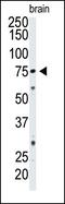 5'-Nucleotidase Ecto antibody, 60-899, ProSci, Western Blot image 