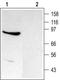 Transient Receptor Potential Cation Channel Subfamily C Member 4 antibody, NB200-605, Novus Biologicals, Western Blot image 