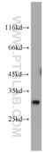 Quinoid Dihydropteridine Reductase antibody, 14908-1-AP, Proteintech Group, Western Blot image 