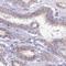 Galactosidase Beta 1 Like 2 antibody, HPA054808, Atlas Antibodies, Immunohistochemistry paraffin image 