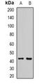 L-2-Hydroxyglutarate Dehydrogenase antibody, orb341416, Biorbyt, Western Blot image 