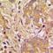Vascular Endothelial Growth Factor B antibody, orb214727, Biorbyt, Immunohistochemistry paraffin image 