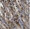 Refilin A antibody, FNab02951, FineTest, Immunohistochemistry paraffin image 