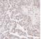 Bromodomain-containing protein 4 antibody, NBP1-18874, Novus Biologicals, Immunohistochemistry frozen image 