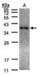 Laforin antibody, GTX104648, GeneTex, Western Blot image 