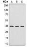 Cathepsin V antibody, MBS821458, MyBioSource, Western Blot image 