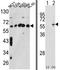 Chaperonin Containing TCP1 Subunit 3 antibody, AP17198PU-N, Origene, Western Blot image 