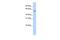 Homeobox protein ARX antibody, PA5-40407, Invitrogen Antibodies, Western Blot image 