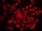 Heterogeneous Nuclear Ribonucleoprotein A3 antibody, orb184070, Biorbyt, Immunohistochemistry paraffin image 