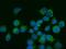 Glutaminase antibody, M01272-3, Boster Biological Technology, Immunofluorescence image 