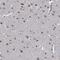 Cytoplasmic tRNA 2-thiolation protein 2 antibody, NBP1-88457, Novus Biologicals, Immunohistochemistry frozen image 