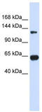 Regulator Of G Protein Signaling 22 antibody, TA333795, Origene, Western Blot image 