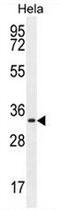 Cyclin H antibody, AP50815PU-N, Origene, Western Blot image 