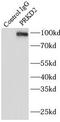 Protein Kinase D2 antibody, FNab06785, FineTest, Immunoprecipitation image 