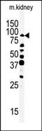 Receptor Interacting Serine/Threonine Kinase 4 antibody, AP14610PU-N, Origene, Western Blot image 