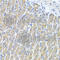 Rac Family Small GTPase 2 antibody, A1139, ABclonal Technology, Immunohistochemistry paraffin image 