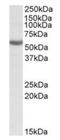 Aldehyde Dehydrogenase 3 Family Member B1 antibody, orb20573, Biorbyt, Western Blot image 