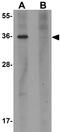 Placenta Enriched 1 antibody, GTX85151, GeneTex, Western Blot image 