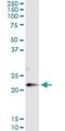 Claudin 14 antibody, H00023562-M01, Novus Biologicals, Immunoprecipitation image 