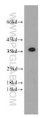 C-Type Lectin Domain Containing 11A antibody, 55019-1-AP, Proteintech Group, Western Blot image 