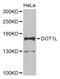 Histone-lysine N-methyltransferase, H3 lysine-79 specific antibody, abx006032, Abbexa, Western Blot image 