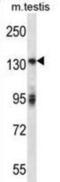 ERBB2 antibody, abx028443, Abbexa, Western Blot image 