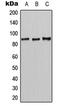 Chloride Voltage-Gated Channel 7 antibody, GTX55139, GeneTex, Western Blot image 