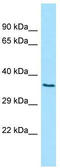 D-2-Hydroxyglutarate Dehydrogenase antibody, TA331322, Origene, Western Blot image 