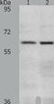 Vanin 2 antibody, TA322714, Origene, Western Blot image 