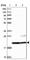 Chromosome 9 Open Reading Frame 40 antibody, HPA042167, Atlas Antibodies, Western Blot image 