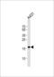 Deoxyuridine Triphosphatase antibody, LS-C167581, Lifespan Biosciences, Western Blot image 